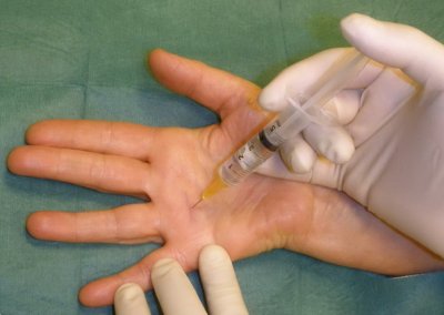 Trattamento di foglia di pioppo tremulo di emorroidi