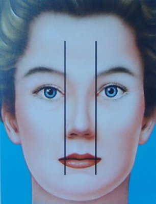 © Dallas Rhinoplasty (QMP) larghezza ideale del naso