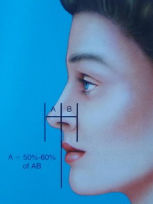 © Dallas Rhinoplasty (QMP) proiezione ideale della punta del naso