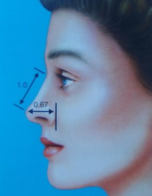 © Dallas Rhinoplasty (QMP) proiezione ideale della punta del naso