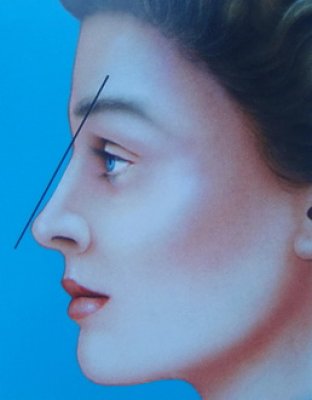 © Dallas Rhinoplasty (QMP) profilo ideale del naso