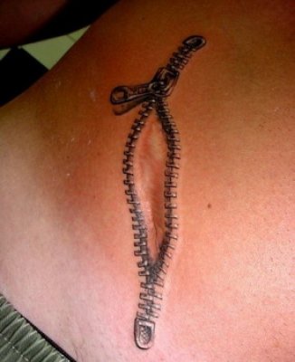 tatuaggio attorno a cicatrice