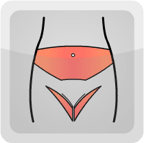 Body contouring massivo - torsoplastica